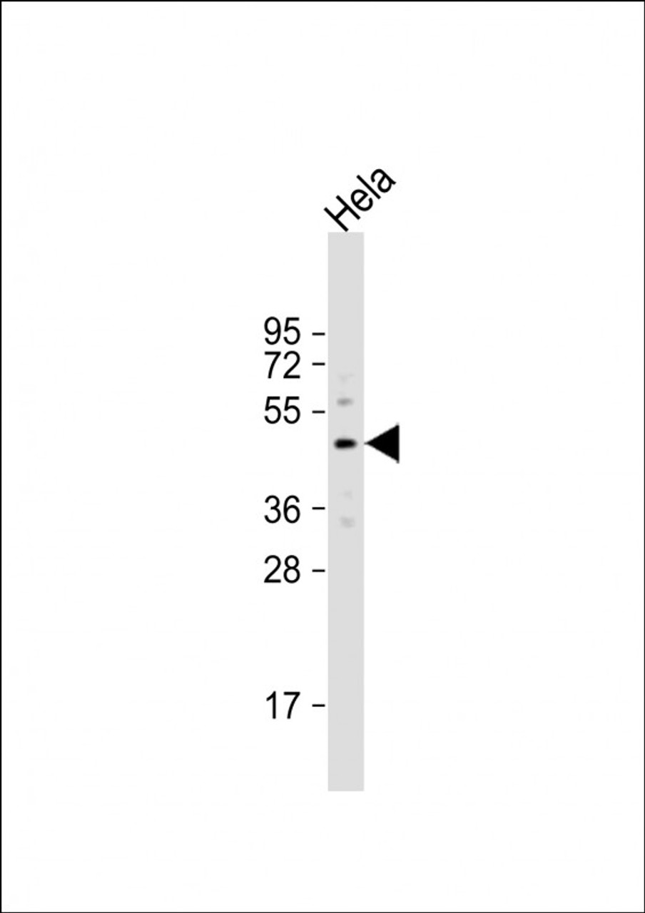 Western Blot at 1:1000 dilution + Hela whole cell lysate Lysates/proteins at 20 ug per lane.