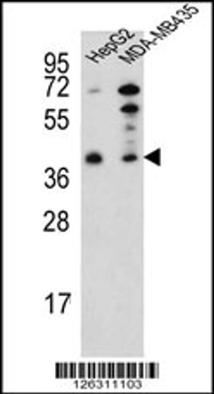 Western blot analysis of PARP16 Antibody in HepG2, MDA-MB435 cell line lysates (35ug/lane)