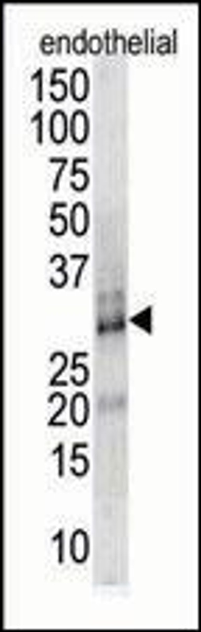 Antibody is used in Western blot to detect DSCR1 in endothelial cell lysate.