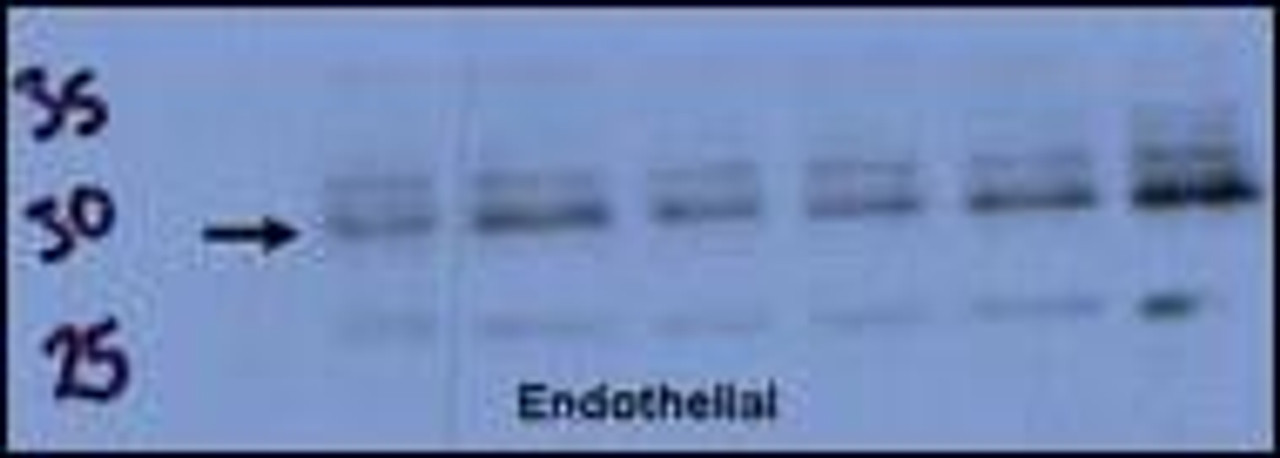 Endothelial cell lysate transferred to membrane was incubated with primary antibody at a 1:500 dilution in 2% BSA in TBST at 4 deg C overnight. Data courtesy of Dr. Katherine Healey, NWCRF Institute, School of Biological Sciences, University of Wales Bangor.