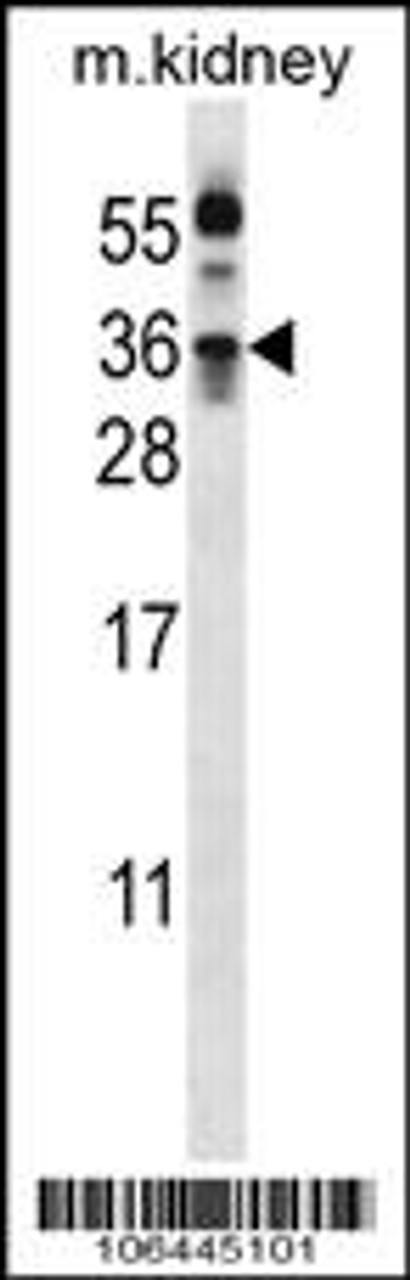 Western blot analysis in mouse kidney tissue lysates (35ug/lane) .