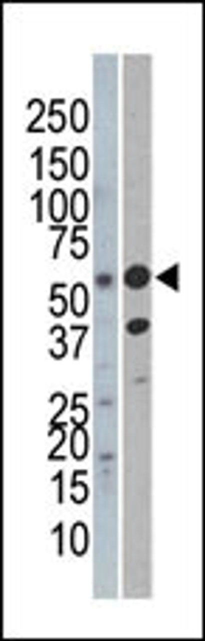 Western blot analysis of anti-C-rel (NFkB) Pab (AP6336c) in Jurkat (left) and mouse kidney (right) cell line lysate.