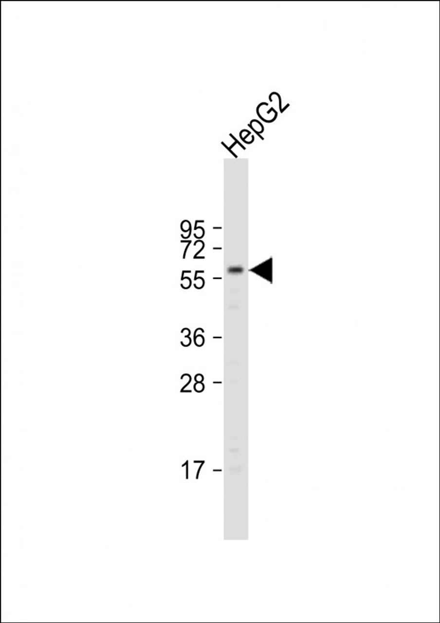 Western Blot at 1:1000 dilution + HepG2 whole cell lysate Lysates/proteins at 20 ug per lane.