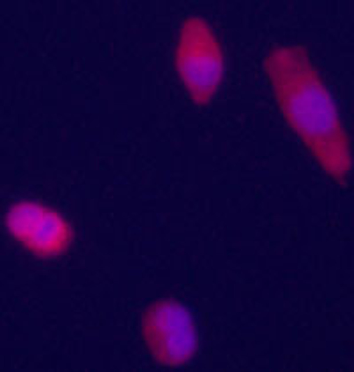 Immunofluorecence staining of anti-GPC3 Pab on HepG2 cells. The cells were acetone fixated. Antibody dilution of 1:50. Original magnification 1:400. Data and protocol courtesy of Dr. Mariana Dabeva, Department of Medicine at Albert Einstein College of Medicine.