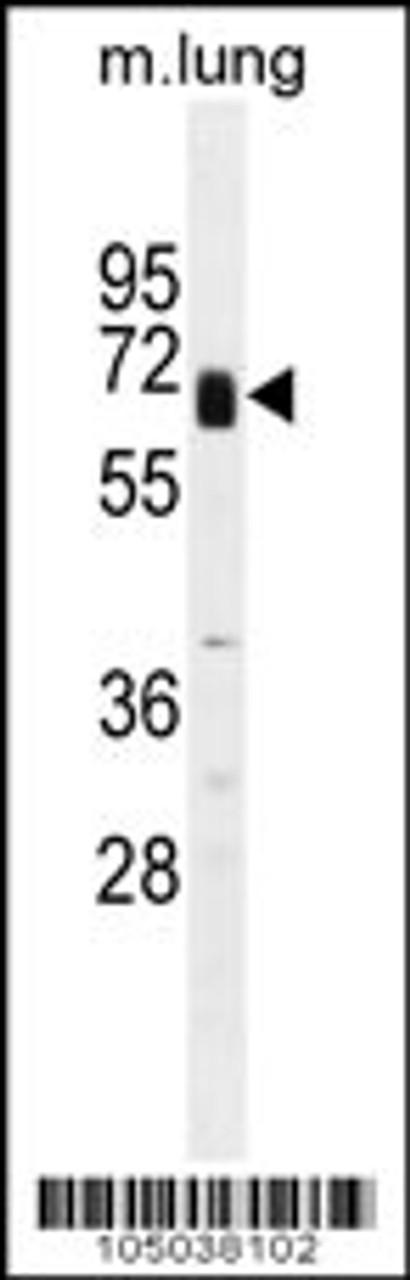 Western blot analysis in mouse lung tissue lysates (35ug/lane) .This demonstrates the GPC3 antibody detected the GPC3 protein (arrow) .
