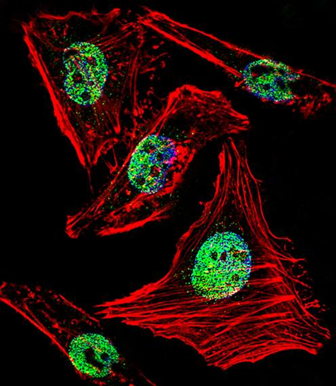 Fluorescent confocal image of Hela cell stained with ZBTB7B Antibody .Hela cells were fixed with 4% PFA (20 min) , permeabilized with Triton X-100 (0.1%, 10 min) , then incubated with ZBTB7B primary antibody (1:25) . For secondary antibody, Alexa Fluor 488 conjugated donkey anti-rabbit antibody (green) was used (1:400) .Cytoplasmic actin was counterstained with Alexa Fluor 555 (red) conjugated Phalloidin (7units/ml) . Nuclei were counterstained with DAPI (blue) (10 ug/ml, 10 min) . ZBTB7B immunoreactivity is localized to Nucleus significantly.