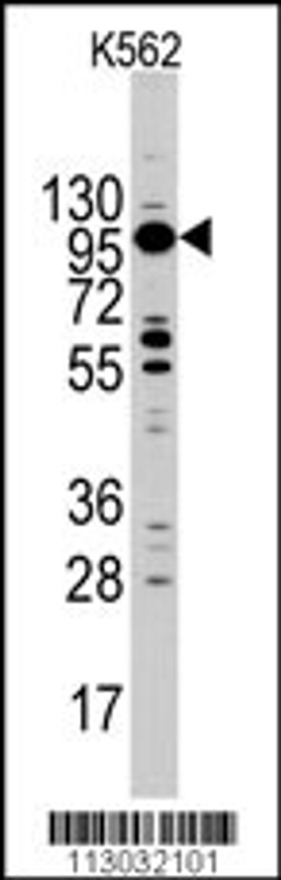 Western blot analysis of MYO1C Antibody in K562 cell line lysates (35ug/lane)