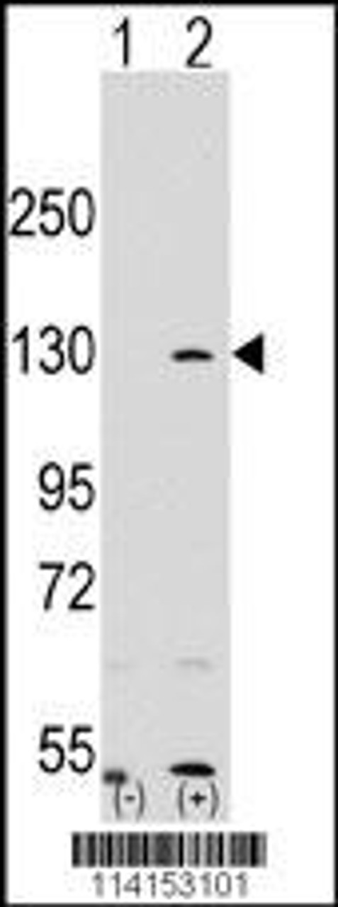 Western blot analysis of PARP1 using rabbit polyclonal PARP1 Antibody using 293 cell lysates (2 ug/lane) either nontransfected (Lane 1) or transiently transfected with the PARP1 gene (Lane 2) .