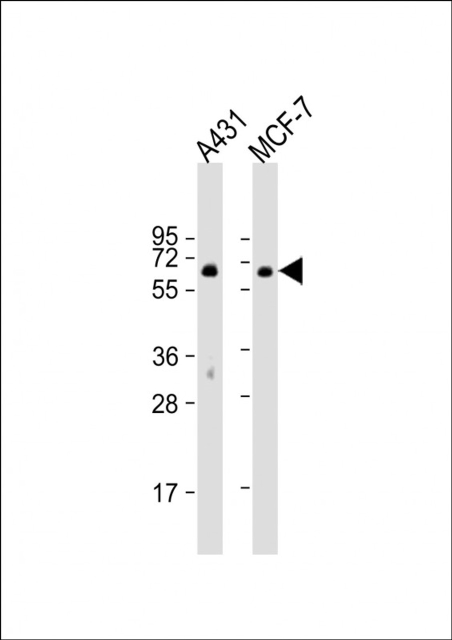 Western Blot at 1:1000 dilution Lane 1: A431 whole cell lysate Lane 2: MCF-7 whole cell lysate Lysates/proteins at 20 ug per lane.
