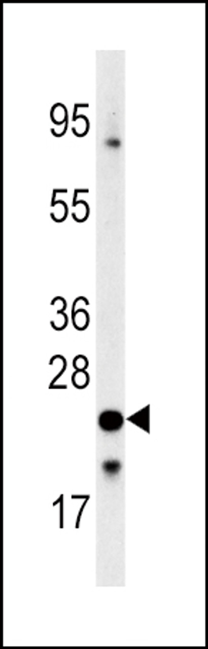Western Blot in 293 cell line lysates (35ug/lane) . FXN (arrow) was detected using the purified Pab.