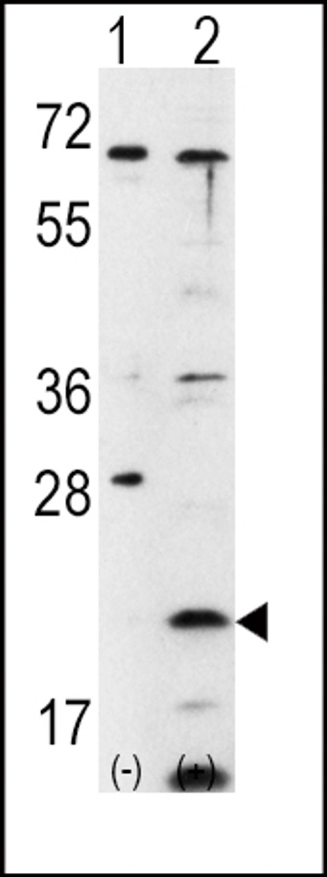 Western blot analysis of FXN using rabbit polyclonal FXN Antibody using 293 cell lysates (2 ug/lane) either nontransfected (Lane 1) or transiently transfected with the FXN gene (Lane 2) .