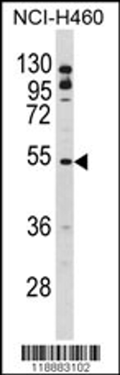 Western blot analysis of BLNK Antibody in NCI-H460 cell line lysates (35ug/lane)