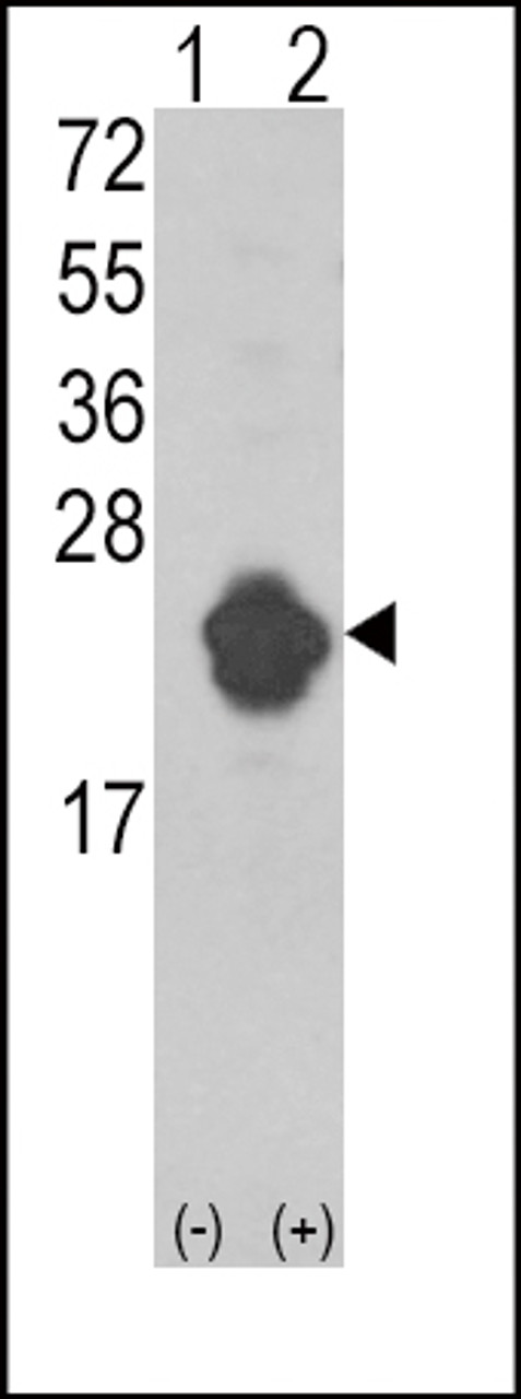 Western blot analysis of IL1RN using rabbit polyclonal IL1RN Antibody using 293 cell lysates (2 ug/lane) either nontransfected (Lane 1) or transiently transfected with the IL1RN gene (Lane 2) .