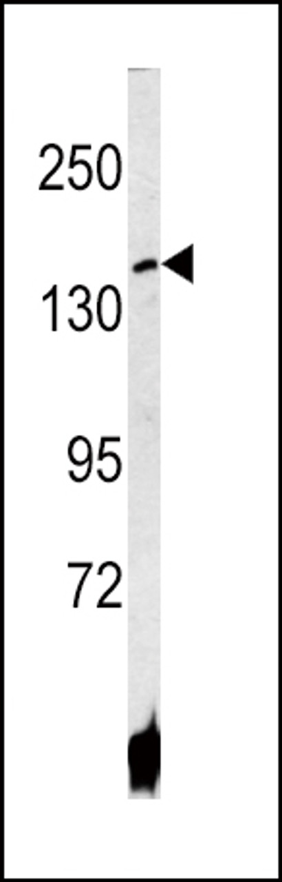 Western blot analysis of ATP7B antibody in HepG2 cell line lysates (35ug/lane)