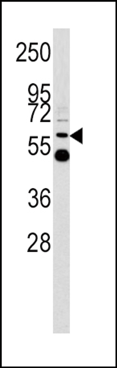 Western blot analysis of UDB17 antibody in Y79 cell line lysates (35ug/lane)