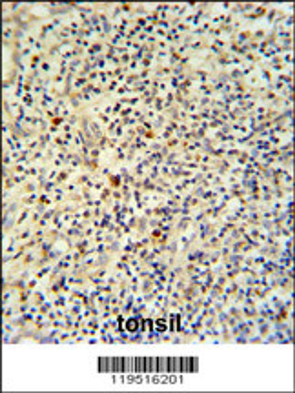 FLI-1 Antibody IHC analysis in formalin fixed and paraffin embedded human tonsil tissue followed by peroxidase conjugation of the secondary antibody and DAB staining.