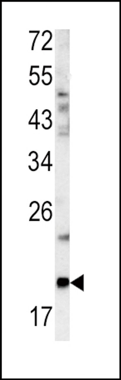 Western blot analysis of GCG antibody in mouse bladder tissue lysates (35ug/lane)