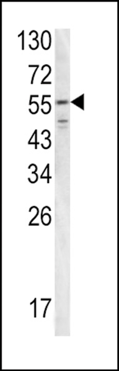 Western blot analysis of FIBB antibody in T47D cell line lysates (35ug/lane)