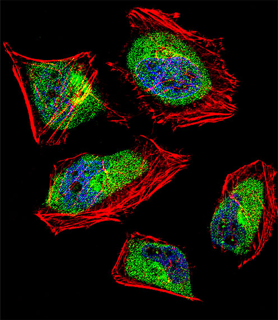 Fluorescent confocal image of Hela cell stained with CNOT8 Antibody .Hela cells were fixed with 4% PFA (20 min) , permeabilized with Triton X-100 (0.1%, 10 min) , then incubated with CNOT8 primary antibody (1:25) . For secondary antibody, Alexa Fluor 488 conjugated donkey anti-rabbit antibody (green) was used (1:400) .Cytoplasmic actin was counterstained with Alexa Fluor 555 (red) conjugated Phalloidin (7units/ml) . Nuclei were counterstained with DAPI (blue) (10 ug/ml, 10 min) . CNOT8 immunoreactivity is localized to Cytoplasm significantly and Nucleus weakly.