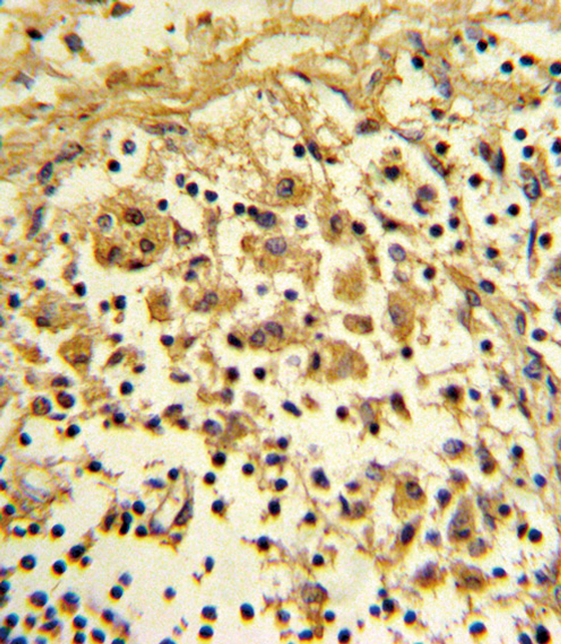 Formalin-fixed and paraffin-embedded human lymph reacted with ENO1 Antibody, which was peroxidase-conjugated to the secondary antibody, followed by DAB staining.