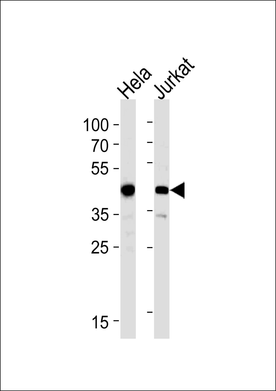 Western blot analysis in Hela, Jurkat cell line lysates (35ug/lane) .