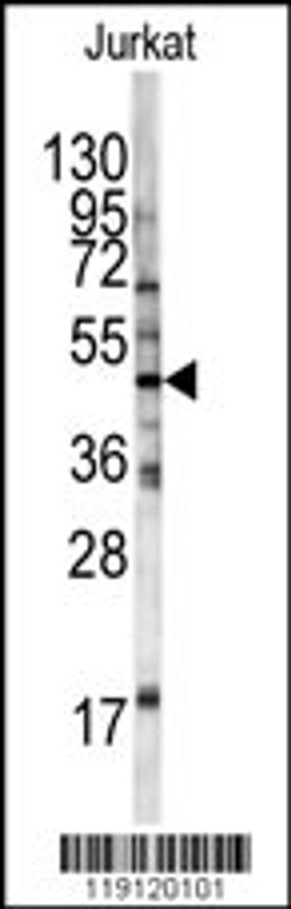 Western blot analysis of HFE antibody in Jurkat cell line lysates (35ug/lane)