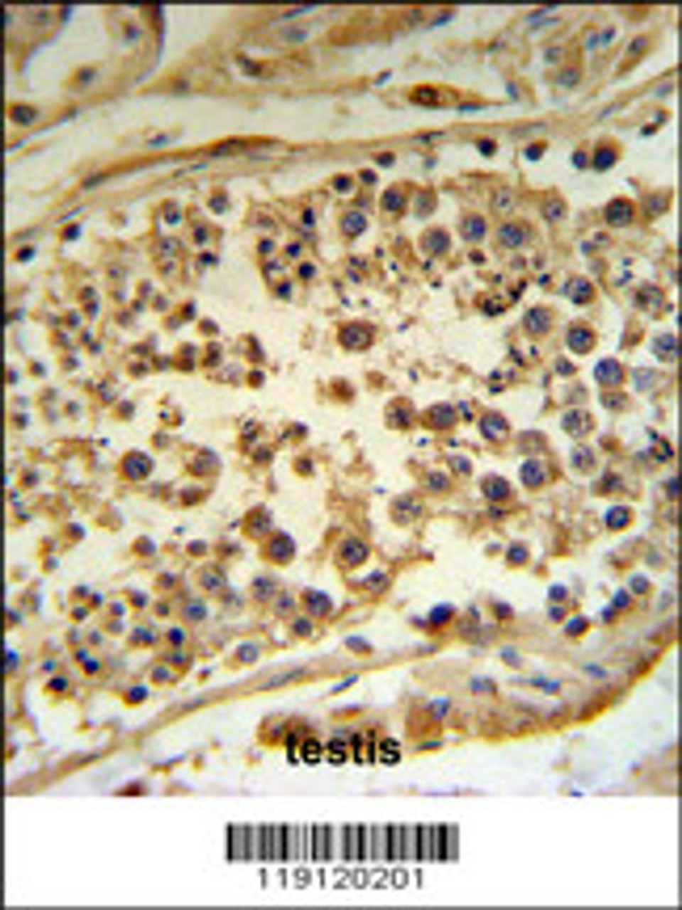 HFE Antibody IHC analysis in formalin fixed and paraffin embedded human testis tissue followed by peroxidase conjugation of the secondary antibody and DAB staining.