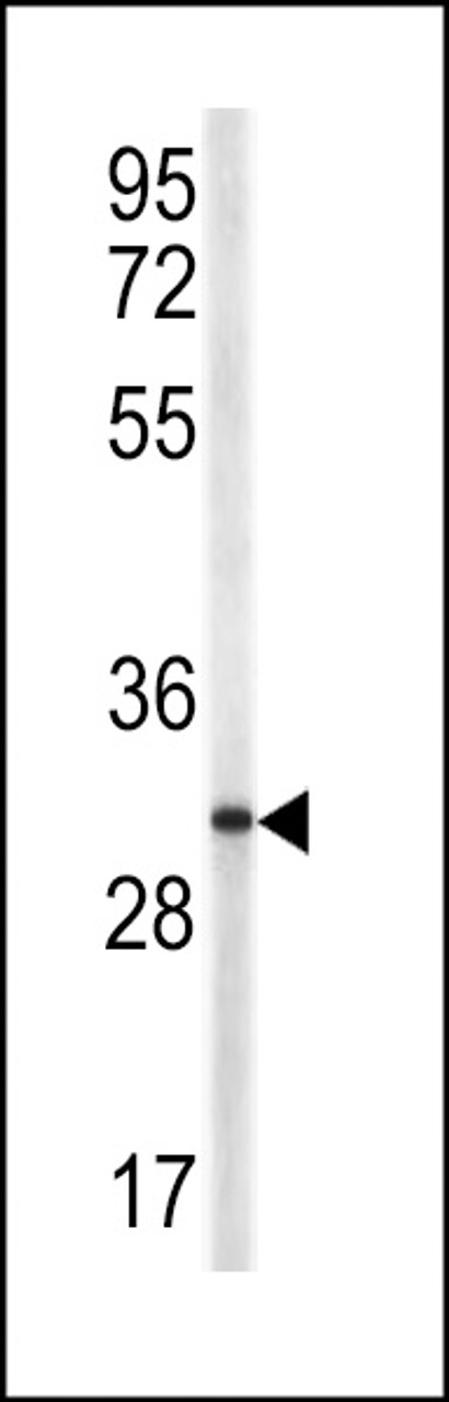 Western blot analysis of TRAP antibody in NCI-H460 cell line lysates (35ug/lane)