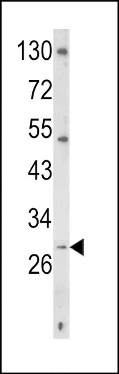 Western blot analysis of TRAP Antibody in K562 cell line lysates (35ug/lane)