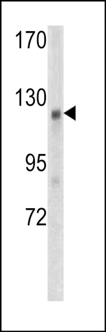 Western blot analysis of WTX antibody in mouse kidney tissue lysates (35ug/lane)