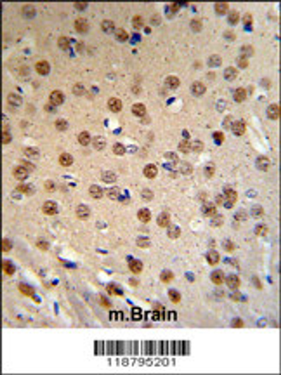 WTX Antibody IHC analysis in formalin fixed and paraffin embedded mouse brain tissue followed by peroxidase conjugation of the secondary antibody and DAB staining.