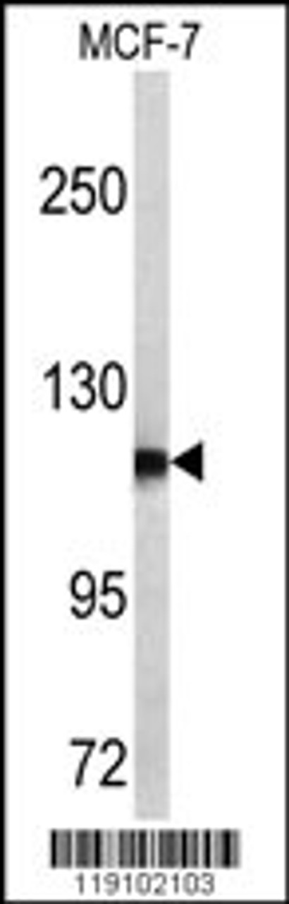 Western blot analysis of PSA antibody in MCF-7 cell line lysates (35ug/lane)