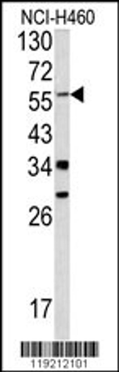 Western blot analysis of YAP1 antibody in NCI-H460 cell line lysates (35ug/lane)