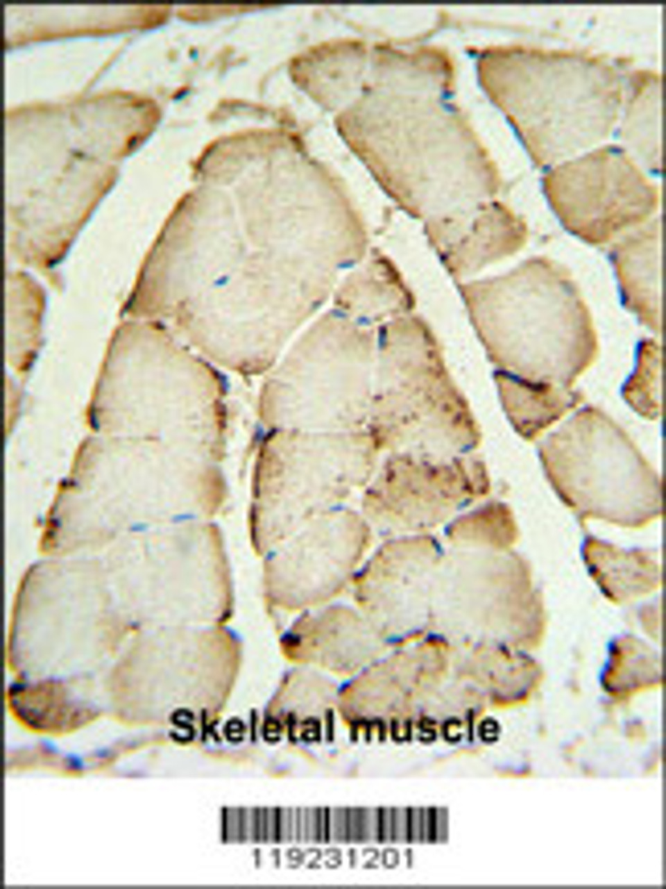 CRAT Antibody IHC analysis in formalin fixed and paraffin embedded human Skeletal muscle followed by peroxidase conjugation of the secondary antibody and DAB staining.