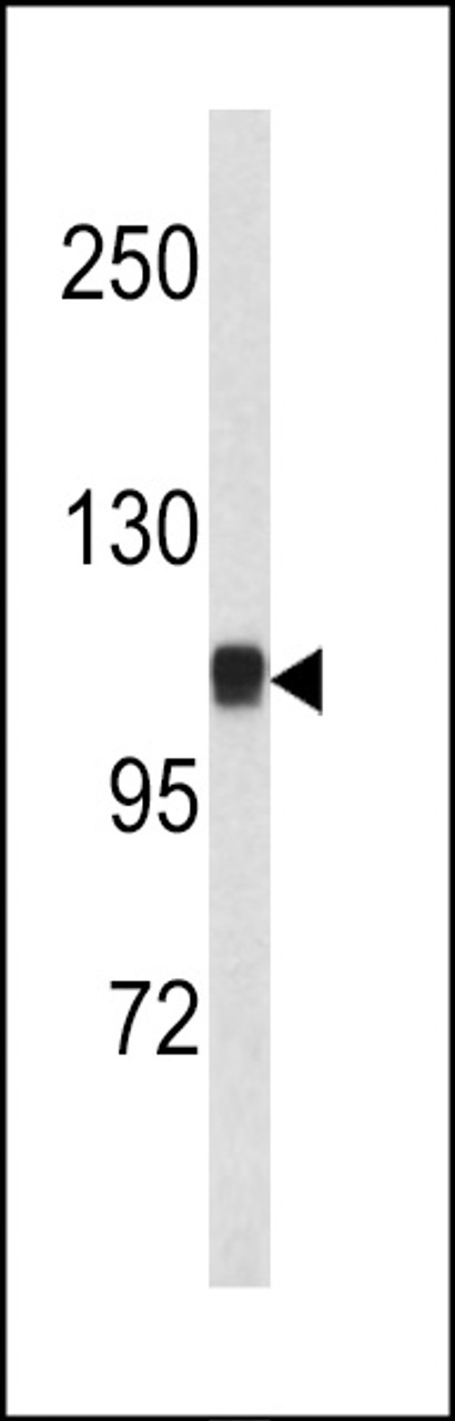 Western blot analysis of CTNA1 antibody in mouse bladder tissue lysates (35ug/lane)