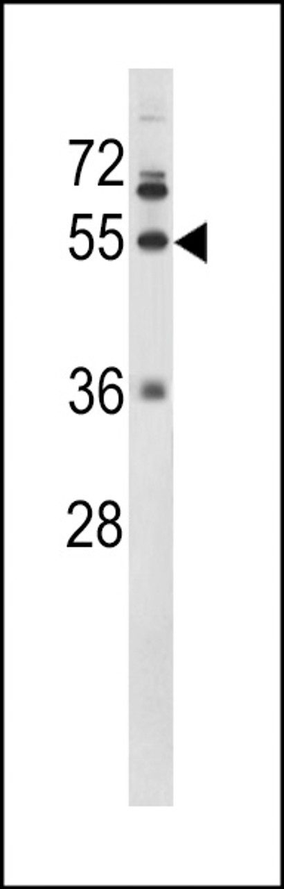 Western blot analysis of FIBG Antibody in NCI-H460 cell line lysates (35ug/lane)