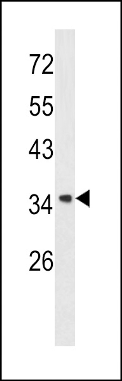 Western blot analysis of Annexin A1 antibody in A2058 cell line lysates (35ug/lane)