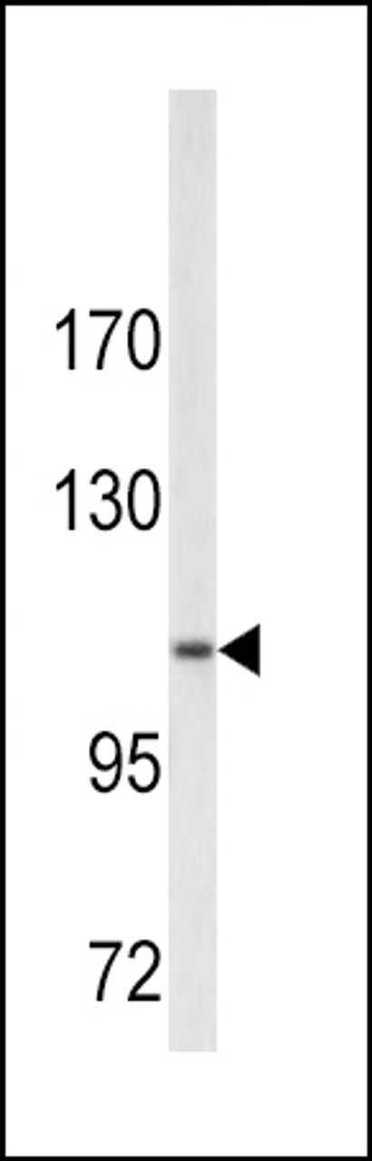 Western blot analysis of COL6A1 antibody in A2058 cell line lysates (35ug/lane)