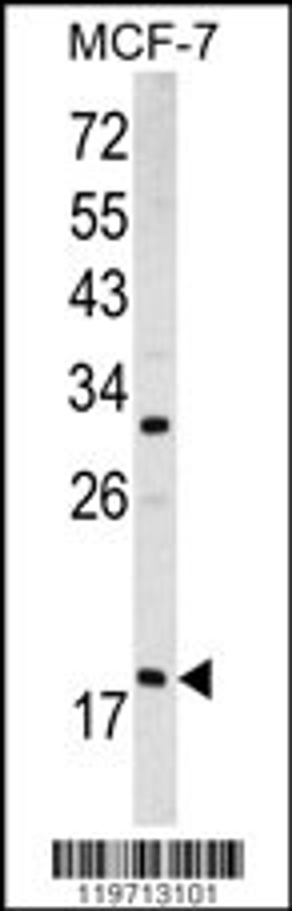 Western blot analysis of ARF3 antibody (Center D93) in MCF-7 cell line lysates (35ug/lane)