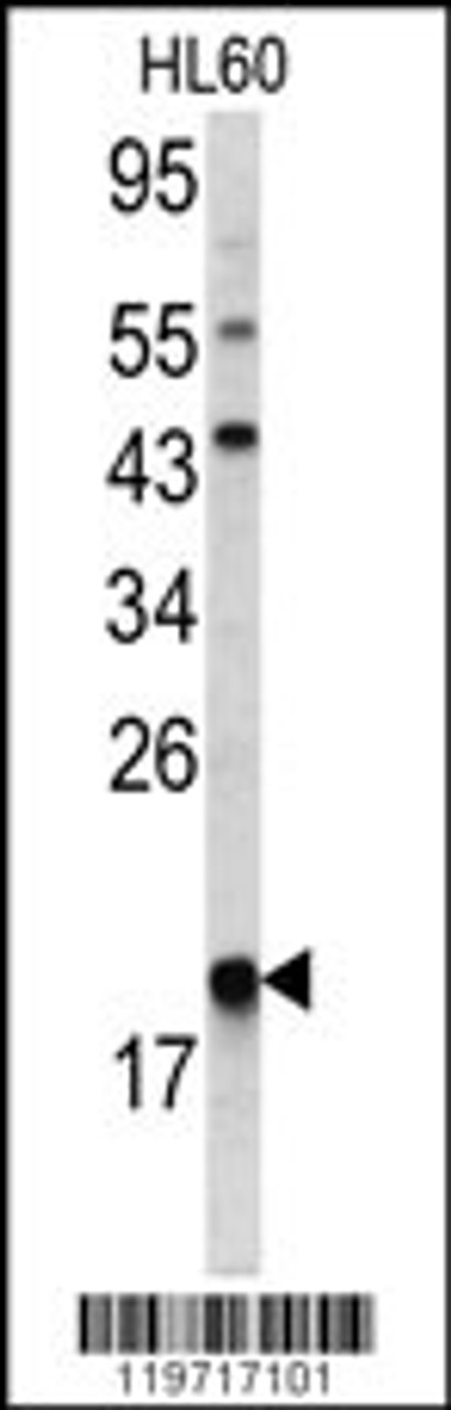 Western blot analysis of ARPC3 antibody in HL60 cell line lysates (35ug/lane)