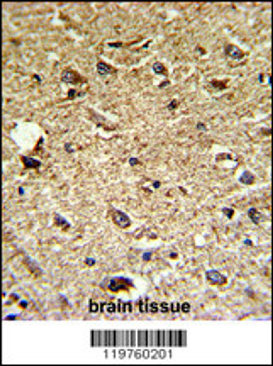 Formalin-fixed and paraffin-embedded human brain tissue reacted with CCRN4L Antibody, which was peroxidase-conjugated to the secondary antibody, followed by DAB staining.