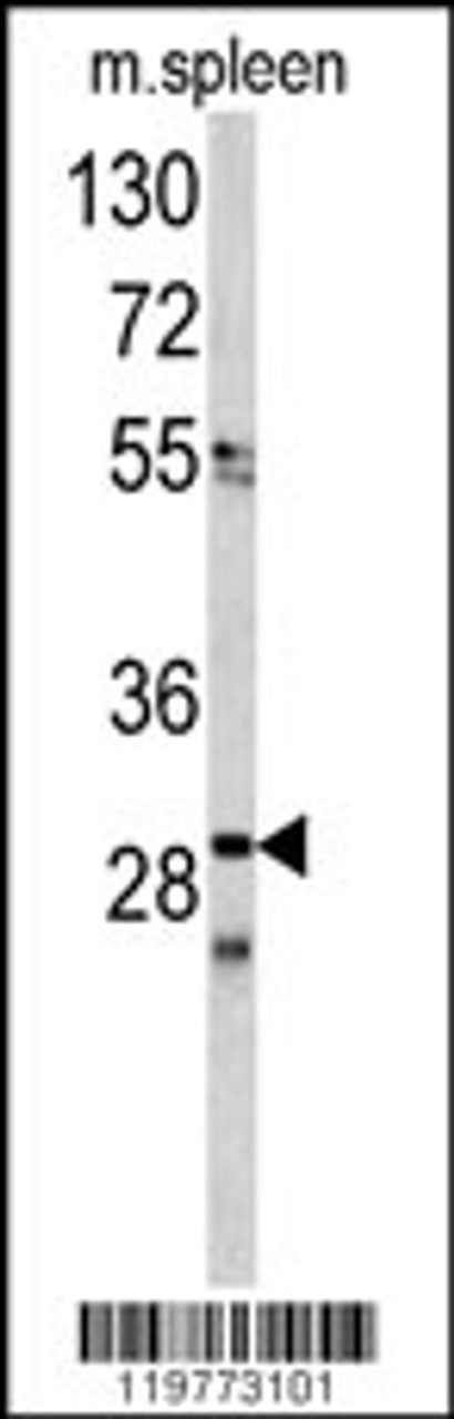 Western blot analysis of CDCA3 antibody in mouse spleen tissue lysates (35ug/lane)