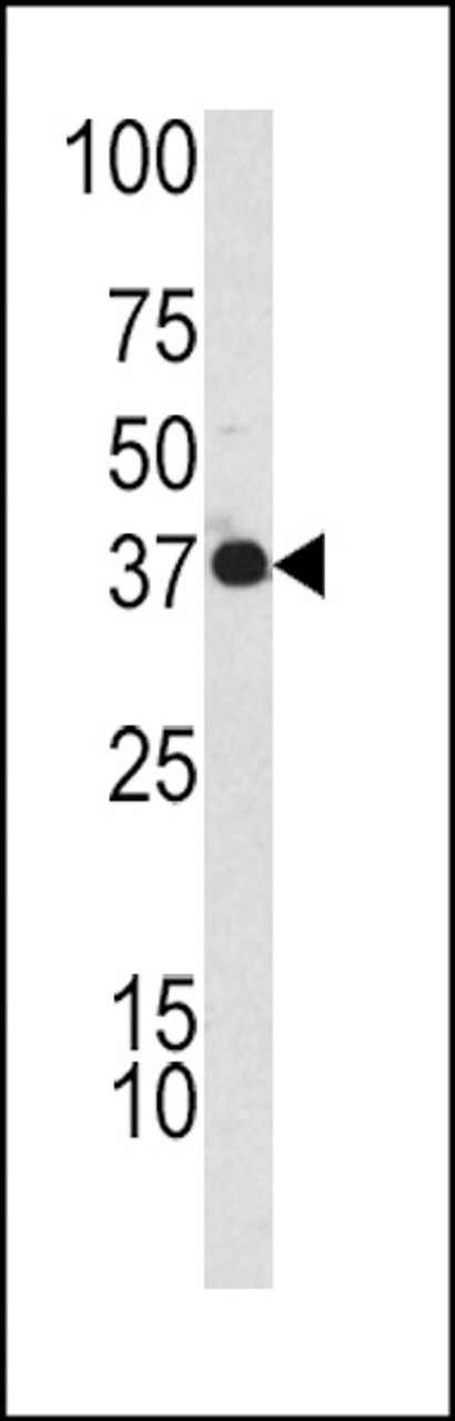 Western blot analysis of CFHL1 antibody in K562 cell line lysates (35ug/lane)