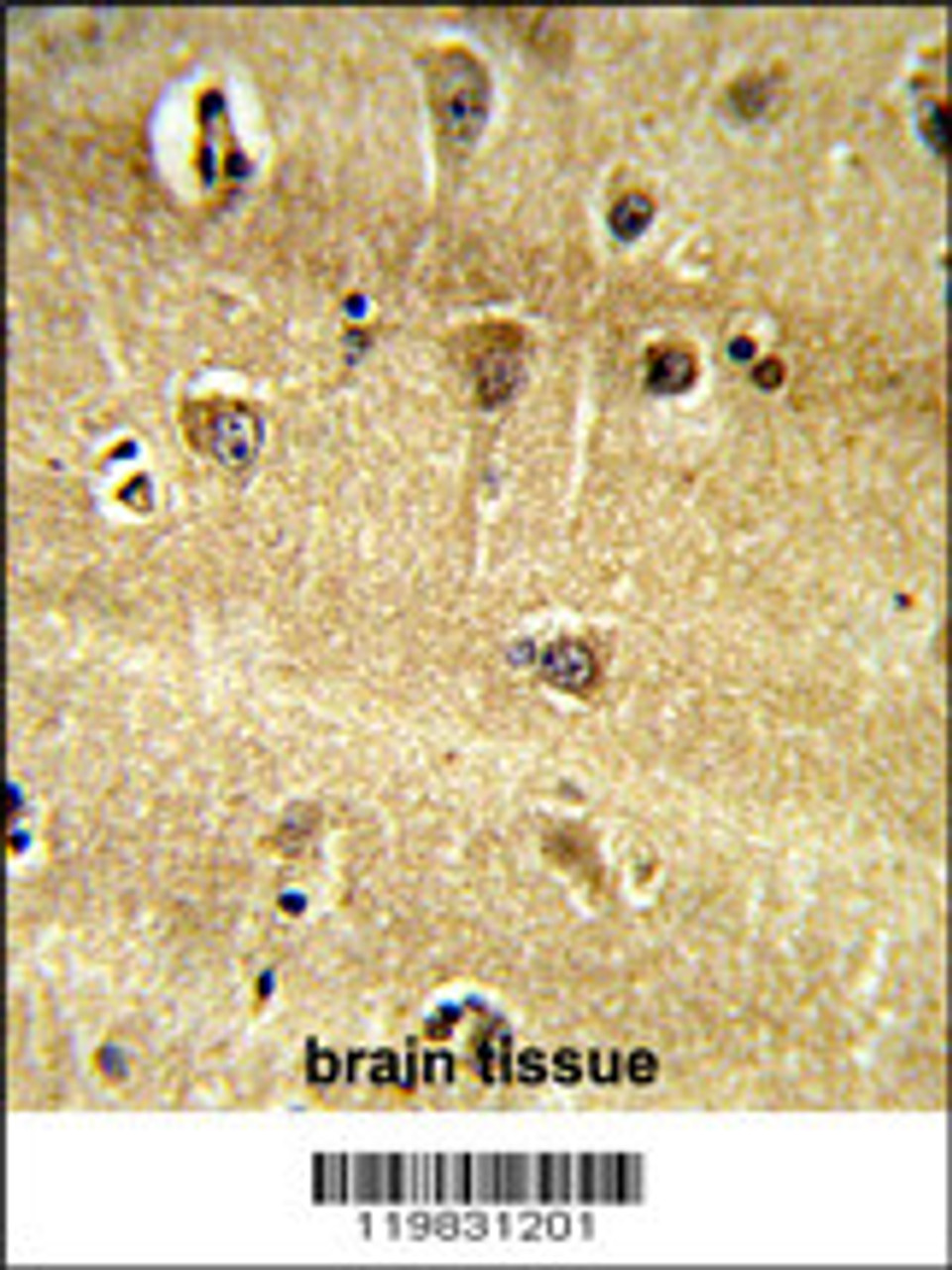 Formalin-fixed and paraffin-embedded human brain tissue reacted with RPS9 Antibody, which was peroxidase-conjugated to the secondary antibody, followed by DAB staining.