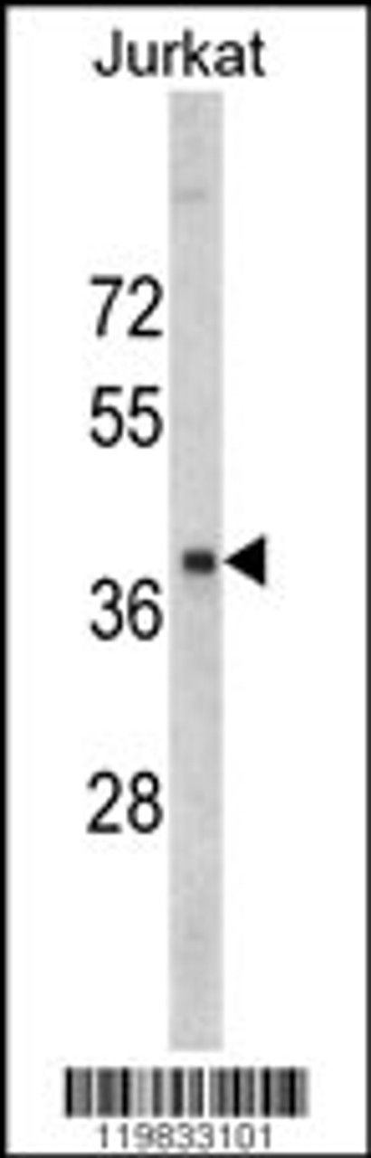 Western blot analysis of RRM2 antibody in Jurkat cell line lysates (35ug/lane)