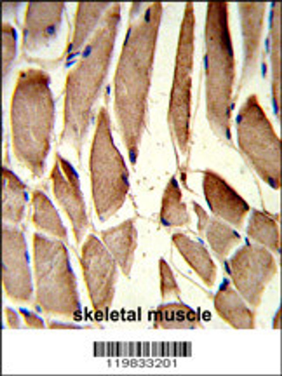 Formalin-fixed and paraffin-embedded human skeletal muscle reacted with RRM2 Antibody, which was peroxidase-conjugated to the secondary antibody, followed by DAB staining.