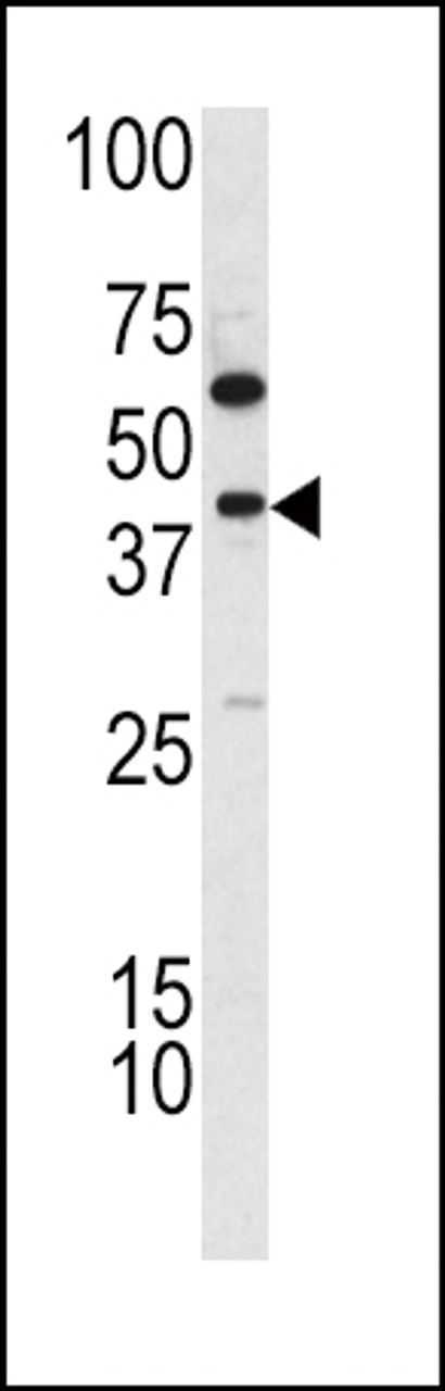 Western blot analysis of TDG antibody in K562 cell line lysates (35ug/lane)