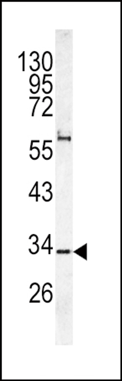 Western blot analysis of CACNG5 antibody in K562 cell line lysates (35ug/lane)