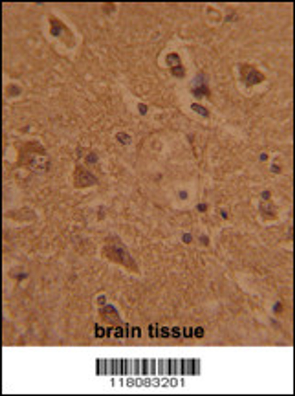Formalin-fixed and paraffin-embedded human brain tissue with CTDP1 Antibody (N-term) , which was peroxidase-conjugated to the secondary antibody, followed by DAB staining.