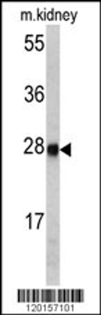 Western blot analysis of ETHE1 antibody in mouse kidney tissue lysates (35ug/lane)